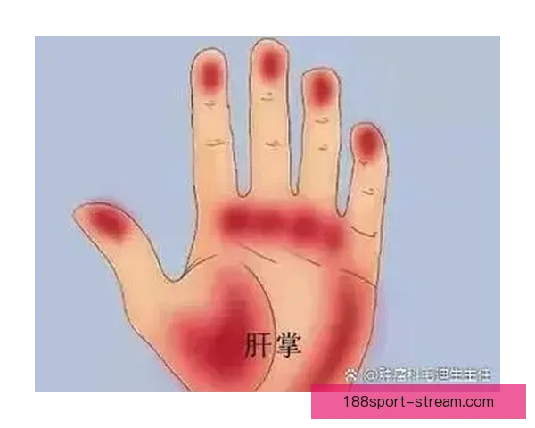 浓眉左手掌恢复良好 本月底接受复查有望本季复出